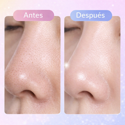 GlowPeel™ Facial